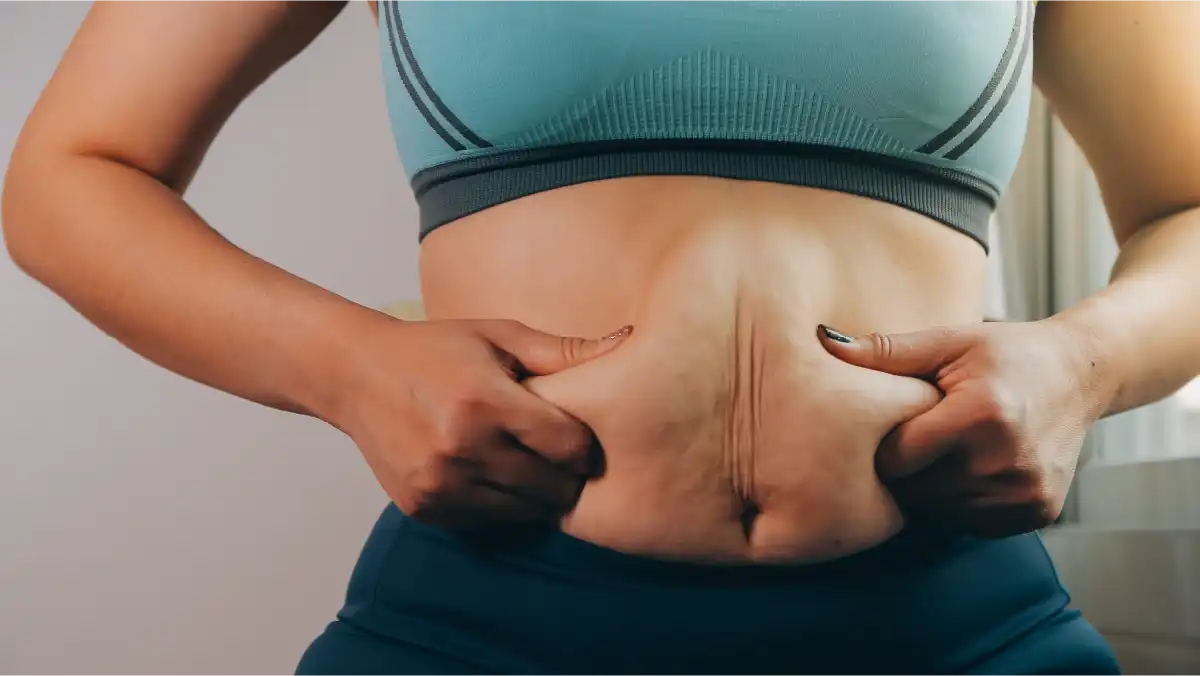 Your suitability for Tummy Tuck