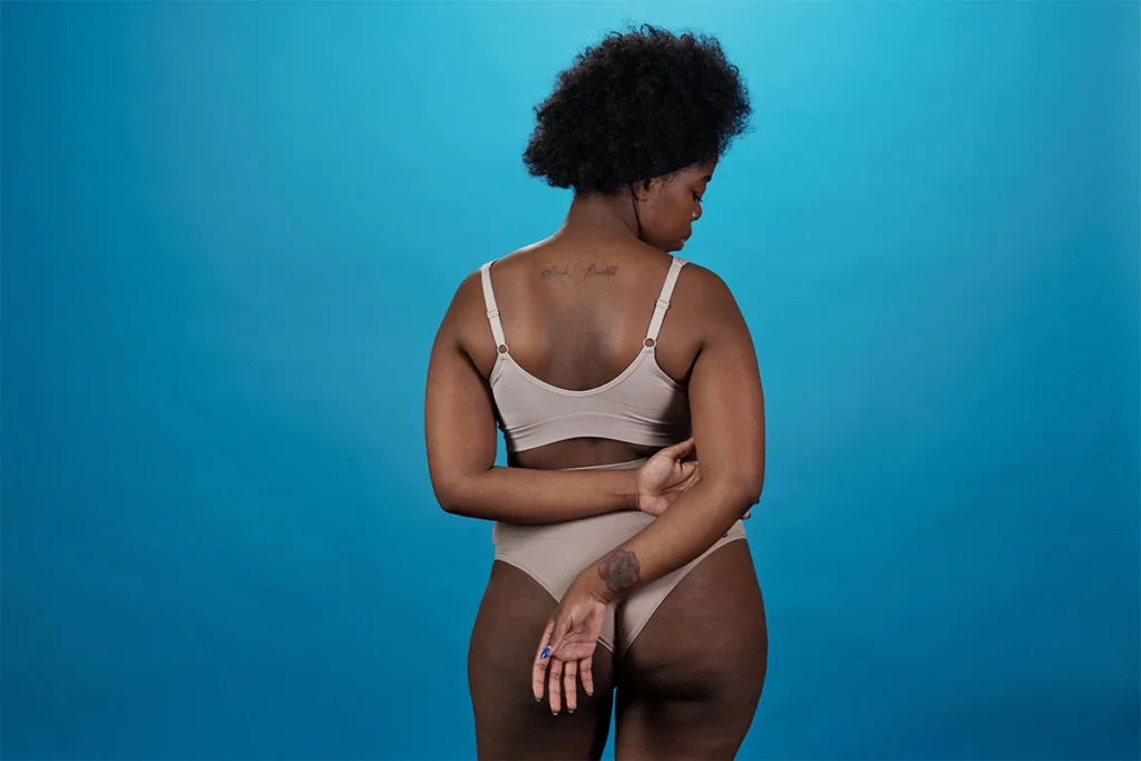 Female back view showing natural body contour relevant to Brazilian Butt Lift fat transfer procedure